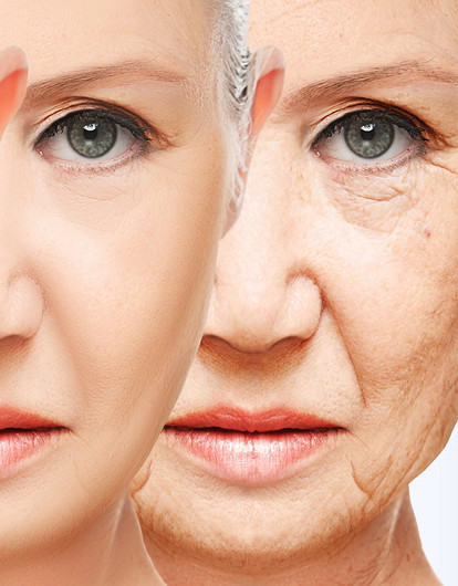 Не мимикой единой: неожиданные привычки, приводящие к морщинам