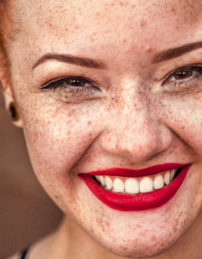 Отбеливание зубов: как сохранить результат как можно дольше (секреты от стоматолога)