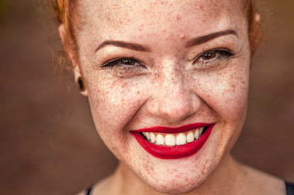 Отбеливание зубов: как сохранить результат как можно дольше (секреты от стоматолога)