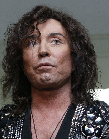 «После операции он не мог закрыть глаза и спал с открытыми»: специалист рассказал о пластике Валерия Леонтьева