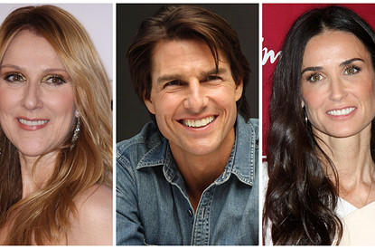 5 звезд, которые полностью перекроили свою улыбку (фото до и после)