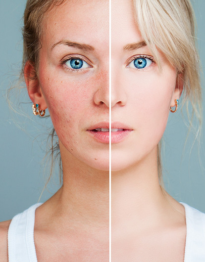 Во всем виноваты гормоны: где искать причину бессонницы, усталости, лишнего веса, бесплодия