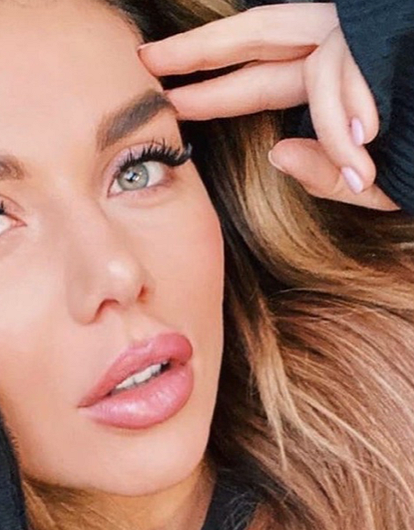 Анна Седокова показала изменившееся из-за тяжелой болезни тело