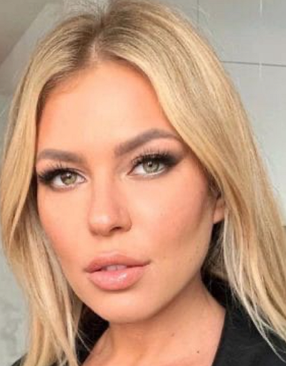 Рита Дакота сделала пластическую операцию