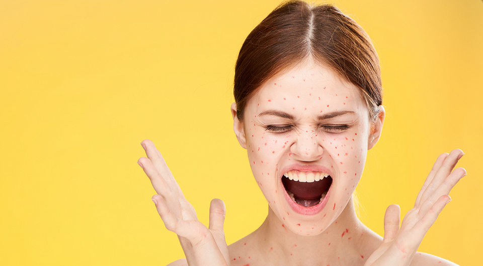 От бледной кожи до прыщей на подбородке: как по лицу определить, на что у тебя аллергия