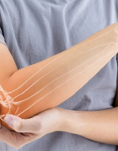 5 неочевидных симптомов остеопороза, которые многие игнорируют