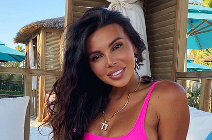 «Щеки как у хомяка»: звезды, которые переборщили с филлерами (и как этого избежать)