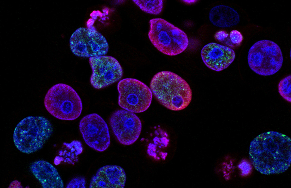 Что такое зомби-клетки и чем они могут быть для нас опасны