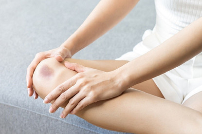 Что делать при ушибе (5 самых важных шагов) и кто в зоне риска осложнений