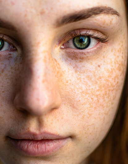 5 самых популярных бьюти-проблем, с которыми приходят к косметологу