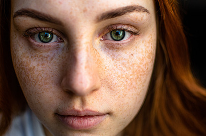 5 самых популярных бьюти-проблем, с которыми приходят к косметологу