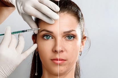 Обратный отсчет: омолаживающие бьюти-процедуры, в которых нуждается каждая женщина