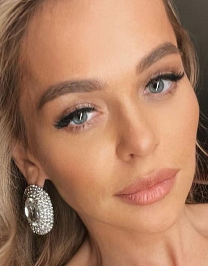 «Становится все хуже и хуже»: Анну Хилькевич укусила змея на Бали