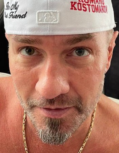 Роман Костомаров впервые вышел в свет в протезах (фото)