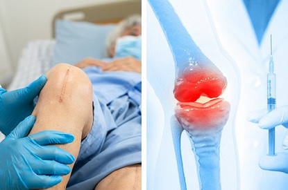 Операция по замене сустава или инъекции? Что эффективнее при лечении коленей