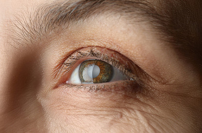 Симптомы катаракты: как вовремя обнаружить, чтобы не запустить болезнь