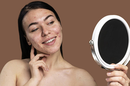 Ретиноиды от акне: спасение для кожи или вред — мнение косметолога