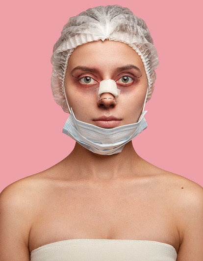 Ринопластика: 7 вещей, которые нужно знать перед операцией