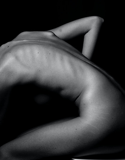 Остеопороз: проверь, находишься ли ты в группе риска