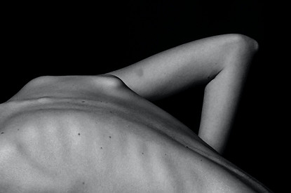 Остеопороз: проверь, находишься ли ты в группе риска