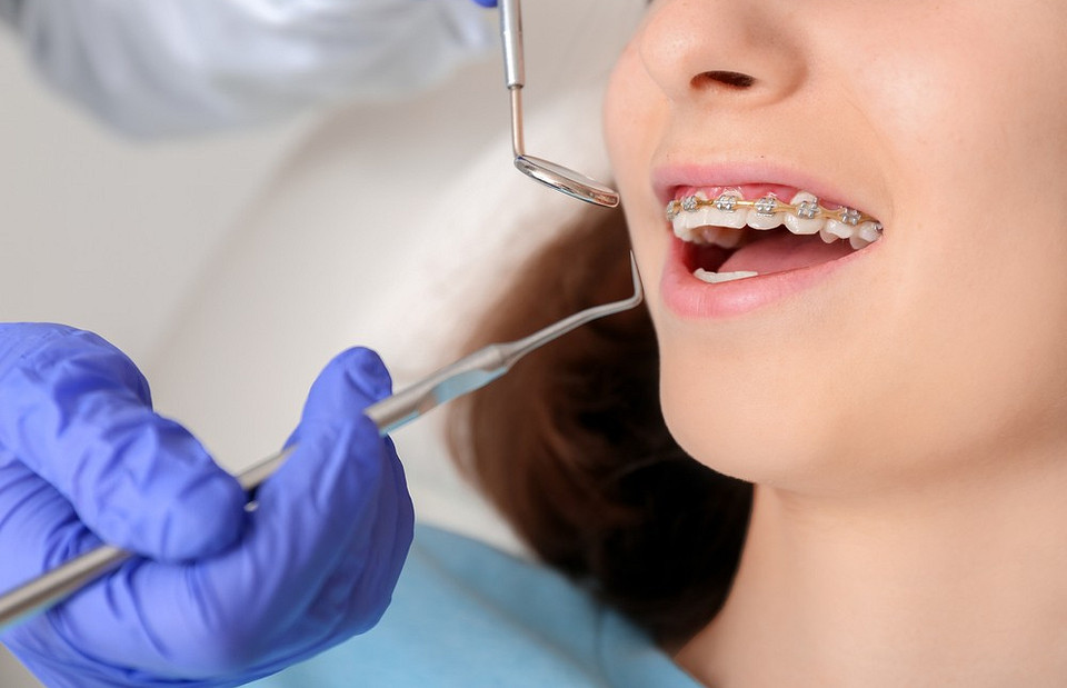 Правильный прикус: 4 мифа, которые давно пора развеять (разбираемся со стоматологом)