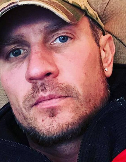 Роману Костомарову ампутировали пальцы рук