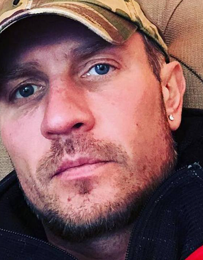 У Романа Костомарова прогрессирует некроз рук после ампутации стоп