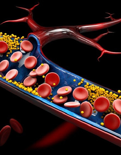 Как снизить холестерин: 8 способов (без приема лекарств)
