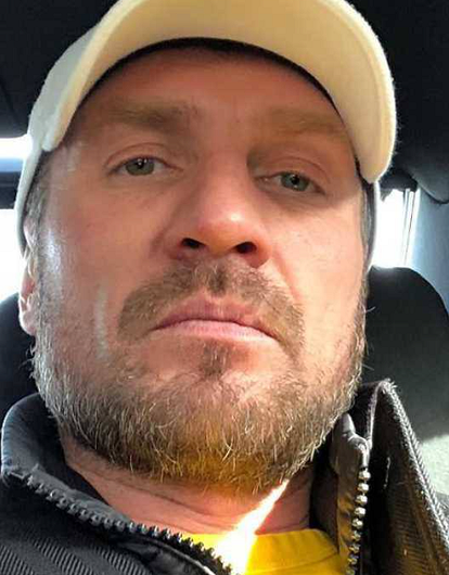 Романа Костомарова готовят к протезированию