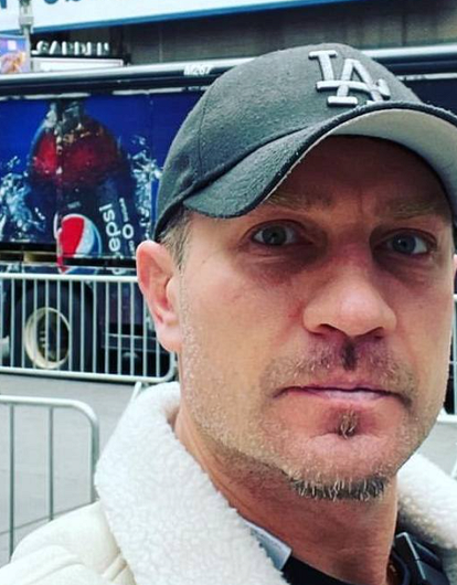 «Повезет, если останется живой»: у Романа Костомарова начался сепсис на руках