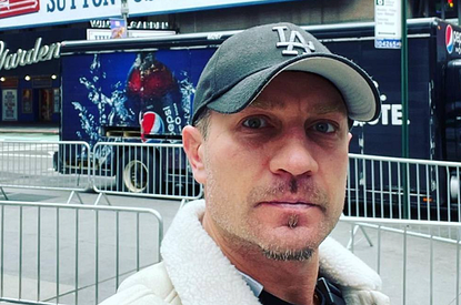 «Повезет, если останется живой»: у Романа Костомарова начался сепсис на руках