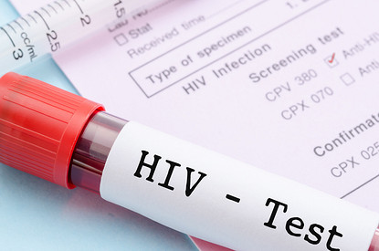 Чем отличается ВИЧ от СПИДа: эксперт объясняет простыми словами