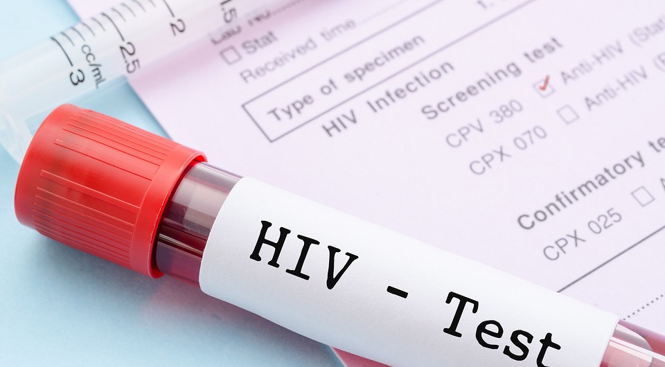 Чем отличается ВИЧ от СПИДа: эксперт объясняет простыми словами
