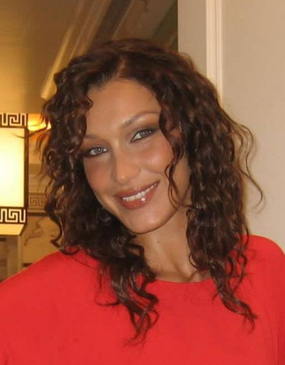 Обострение болезни: у Беллы Хадид отказывают почки