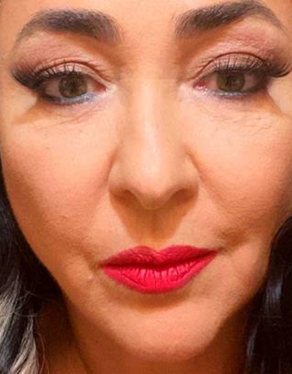 «Провели пластическую операцию»: Лолита показала свой новый образ