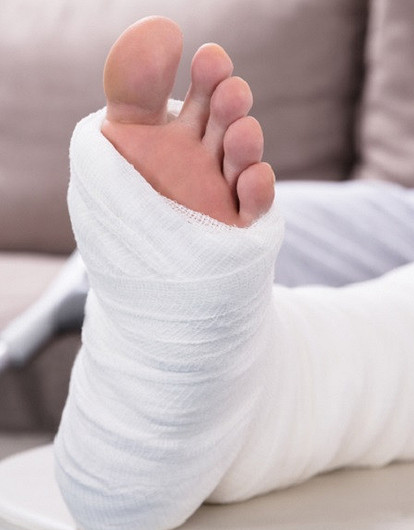 Помощь при переломах