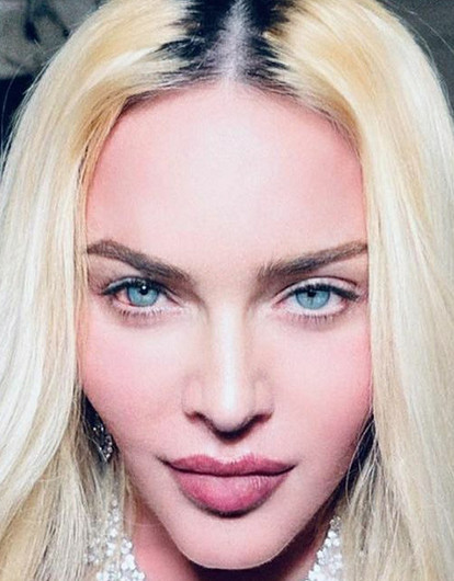 От иммунитета до возраста: что негативно сказывается на пластике — рассказывает кандидат медицинских наук на примере Мадонны