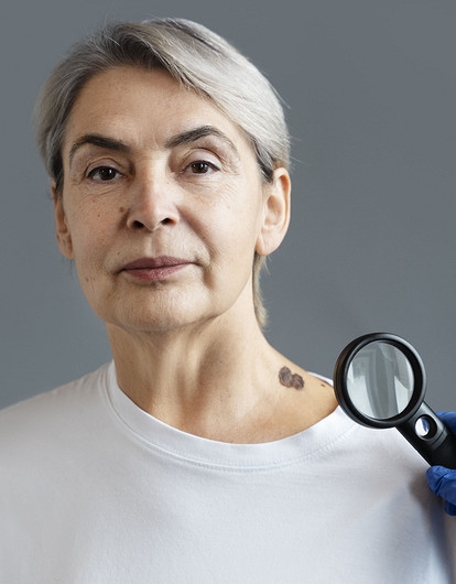 Родинки на теле, которые нужно срочно показать врачу