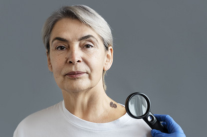 Родинки на теле, которые нужно срочно показать врачу