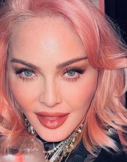 Внешний вид Мадонны после больницы шокировал фанатов