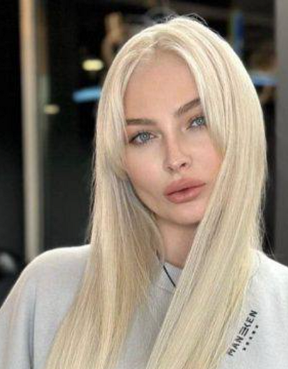 Изменилась до неузнаваемости: Алена Шишкова впервые рассказала о своей болезни
