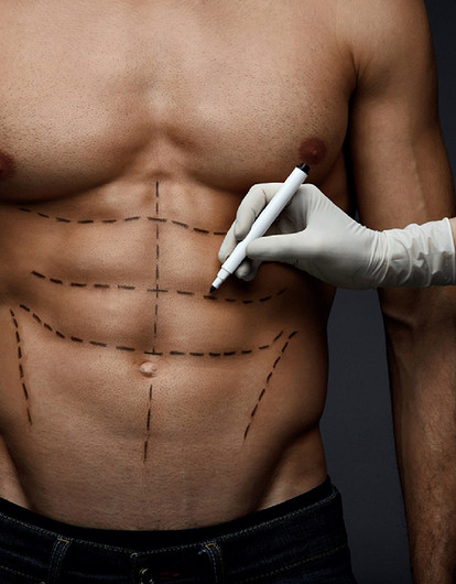 Мужская пластика живота: хирург раскрывает все секреты нового тренда
