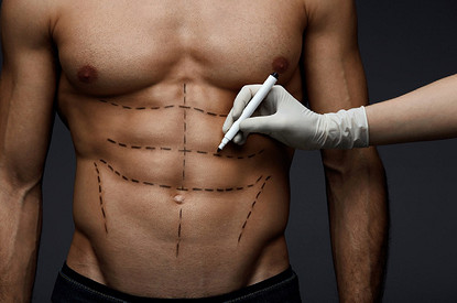 Мужская пластика живота: хирург раскрывает все секреты нового тренда