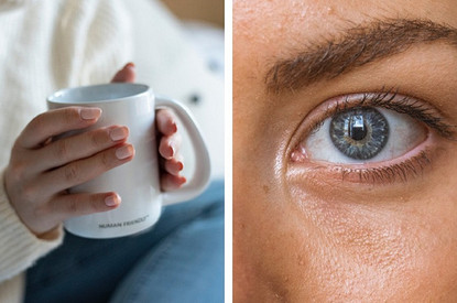 6 неожиданных симптомов ревматоидного артрита, с которыми лучше сразу обратиться к врачу