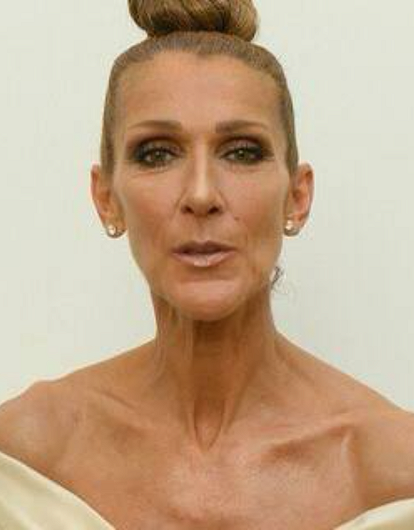 «Мы мало что можем сделать»: появились новые подробности состояния Селин Дион