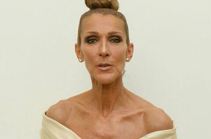 «Мы мало что можем сделать»: появились новые подробности состояния Селин Дион