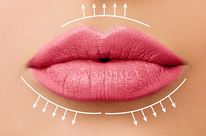 Осьминожки и уточки: какие губы сейчас в моде, а какие из нее вышли