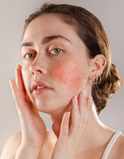 Гиперчувствительность кожи: почему возникает и как за ней ухаживать