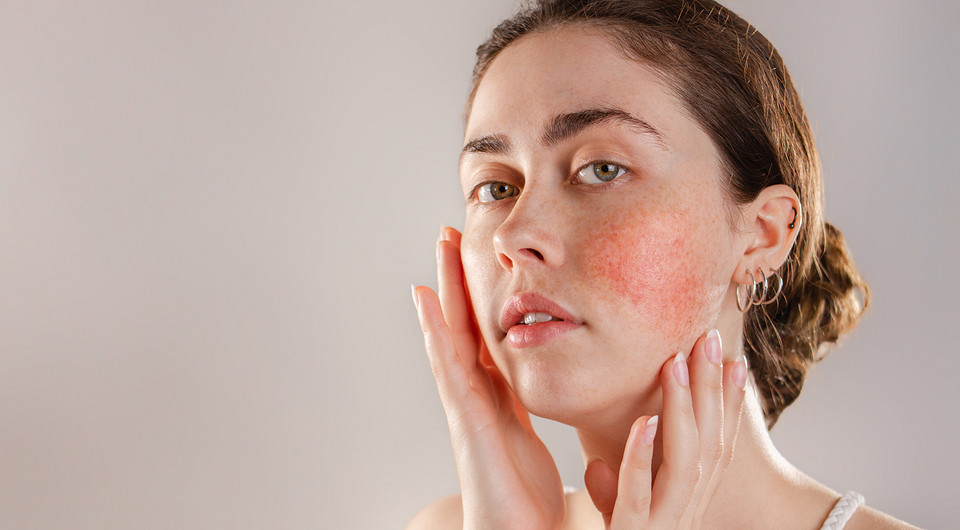 Гиперчувствительность кожи: почему возникает и как за ней ухаживать