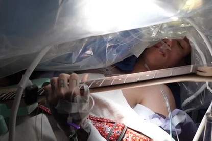 Пациент играл на гитаре во время операции на мозге. Хирург объяснил, зачем это было нужно